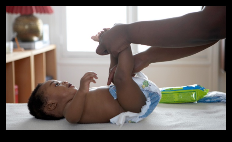 Tender Tushies: Diapering Practices for Baby's Skin Health